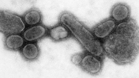 h1n1